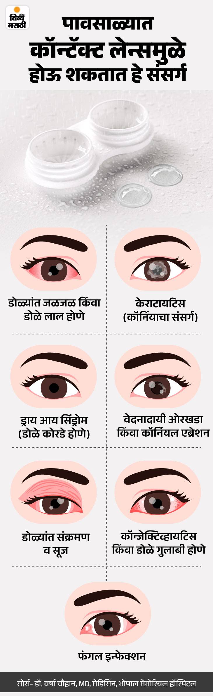 Rainy Season Eye Infections; Contact Lens Safety Tips (Do's And Don'ts