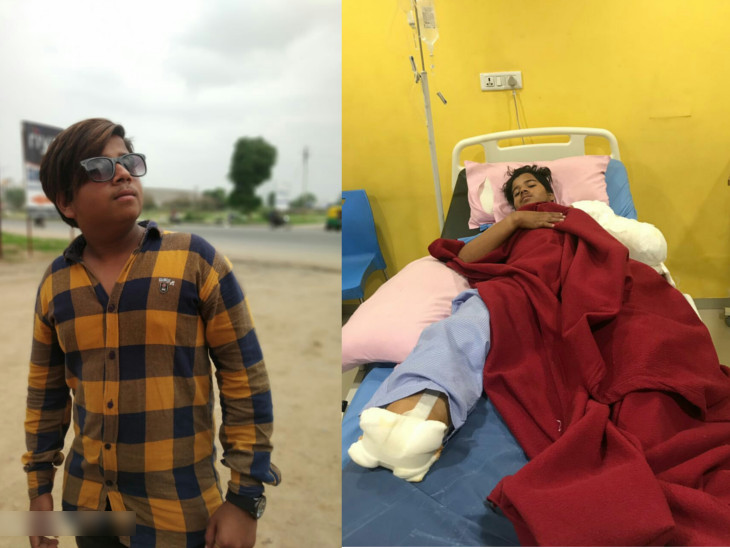 A 17 Years Old Boy Got Electric Shock While Taking Kite From Electric Wire
