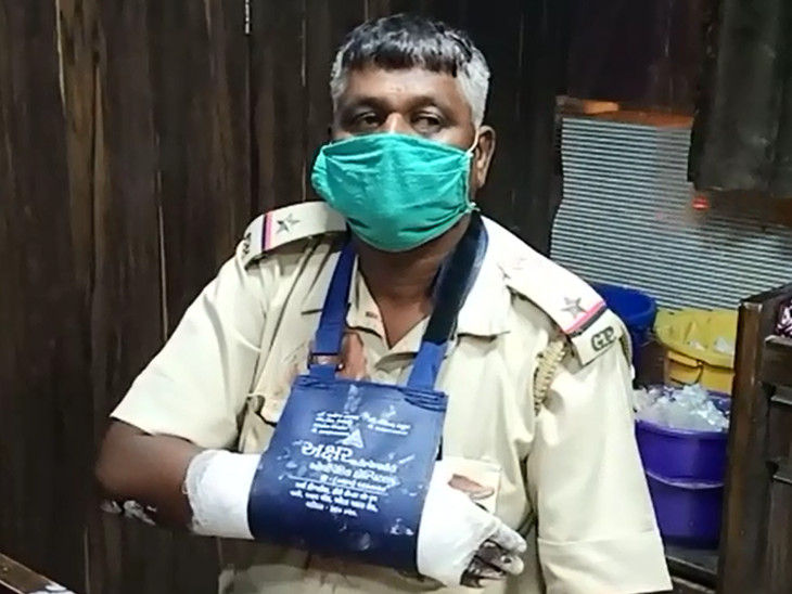 PCR વાનના ASI વિનોદભાઇને હાથમાં ઇજા પહોંચી