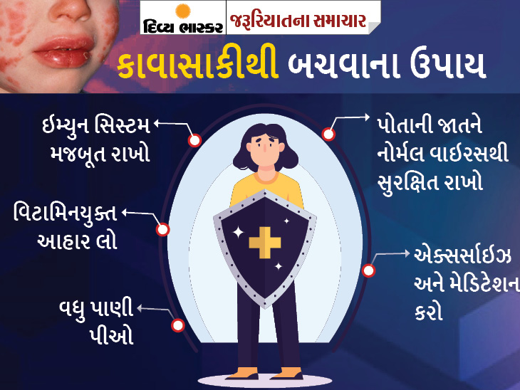 મુંબઈની એક હોસ્પિટલમાં 50% કોરોના પીડિતોમાં કાવાસાકીનાં લક્ષણો, આ રોગ શું છે અને એનાથી બચવાના ઉપાયો જાણો|યુટિલિટી,Utility - Divya Bhaskar