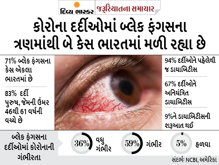 AIIMSએ બ્લેક ફંગસની વહેલી તકે ઓળખ કરવા માટેની રીત જણાવી, ગાઇડલાઇન્સમાં સામેલ તમામ સૂચનો જાણો|યુટિલિટી,Utility - Divya Bhaskar
