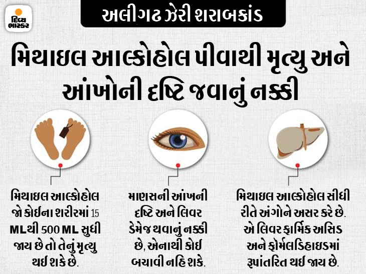 The sight of 80 people's eyes was gone; CMO's claim - 10 to 12 such people are alive and have no idea who died | 80 લોકોની આંખોની દ્રષ્ટિ જતી રહી; CMOનો દાવો- આવા 10થી 12 લોકો જીવતા છે અને જે મૃત્યુ પામ્યા તેના વિશે ખ્યાલ નથી - Vimarsana News
