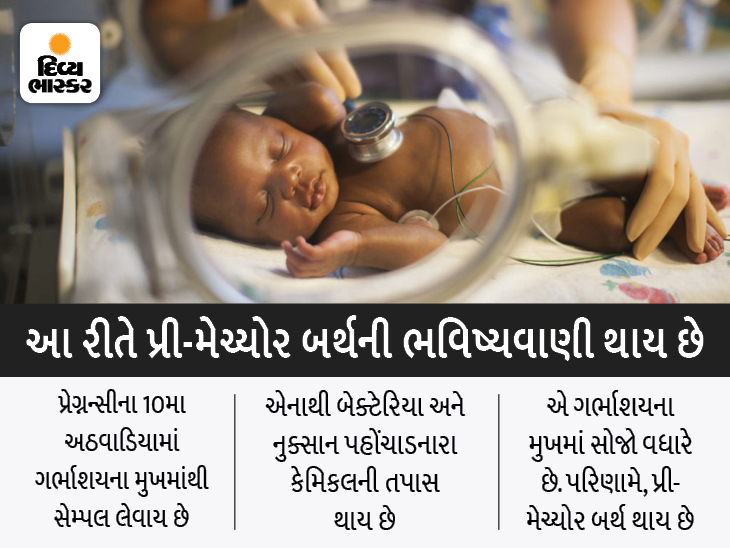 Premature birth prediction possible, scientists develop new test for 10th week of pregnancy | પ્રી મેચ્યોર બર્થની ભવિષ્યવાણી સંભવ બની, વૈજ્ઞાનિકોએ પ્રેગ્નન્સીના10મા અઠવાડિયે કરાતો નવો ટેસ્ટ ડેવલપ કર્યો - Vimarsana News