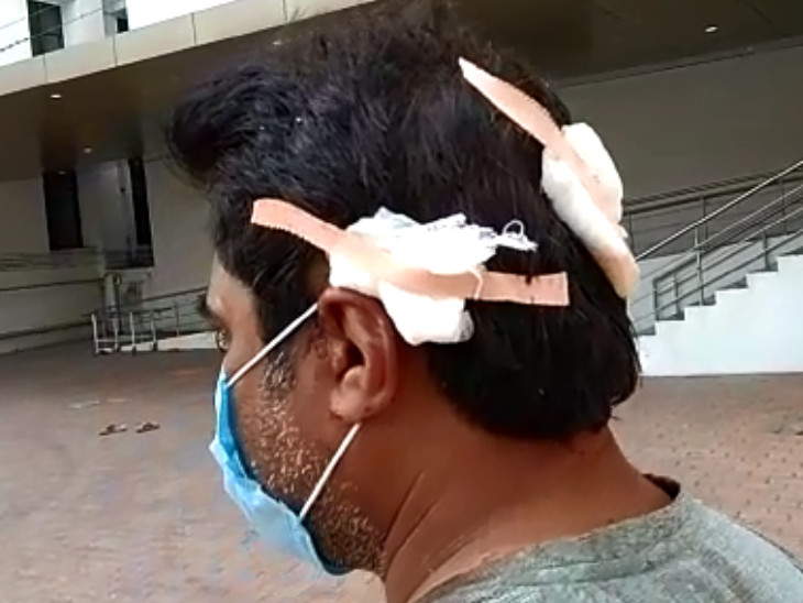 Struck with an ax wound to the head.