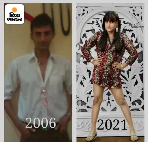 આઇઝીયાનો પહેલાંનો અને અત્યારનો ફોટો