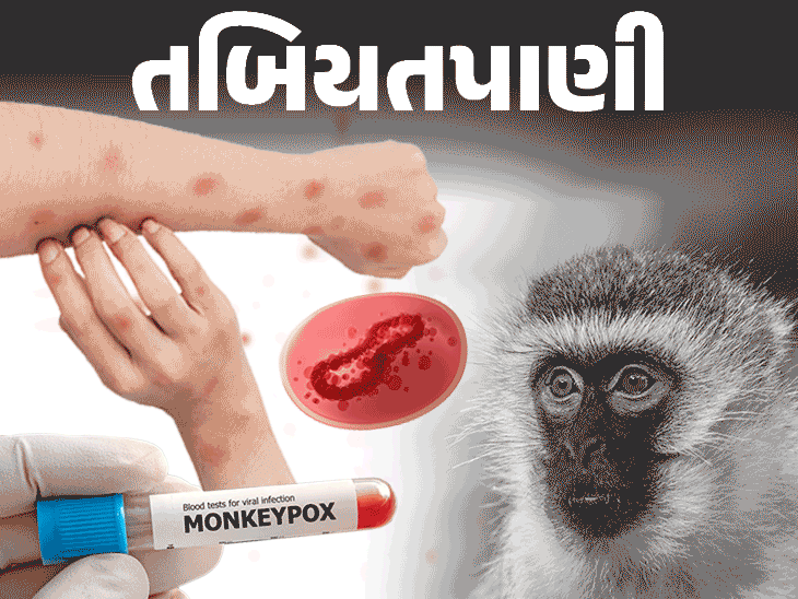 Monkeypox Box Monkeypox is spreading in African countries | આફ્રિકન દેશોમાં મંકીપોક્સ ...