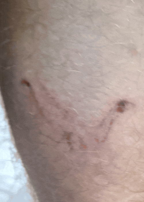 From Germany to Surat