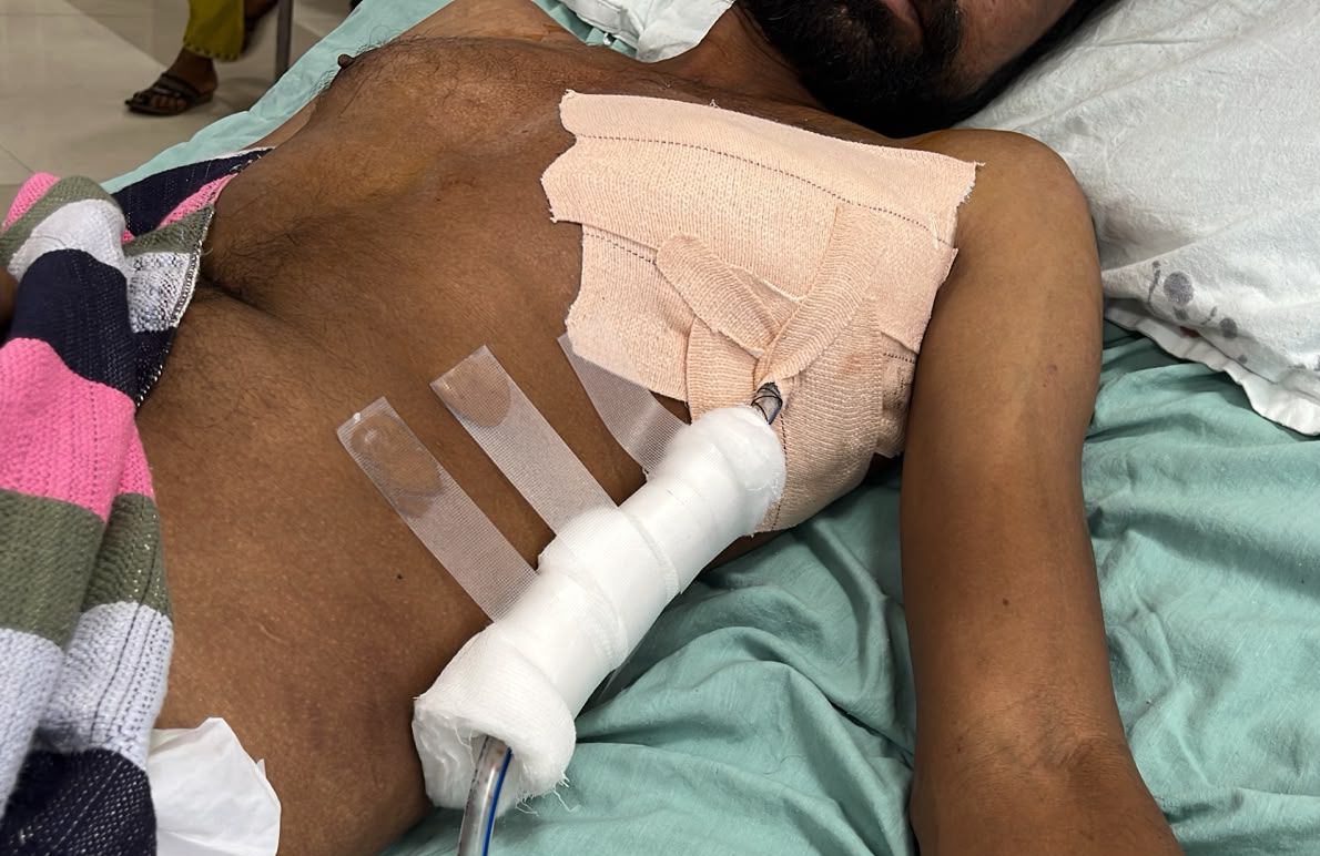 Miraculous Surgery in Surat