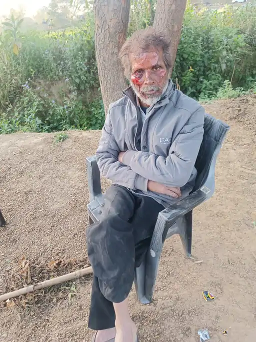 पुलिस-लेखपाल का लालच या गलतियां, जिंदा जल गईं मां-बेटी:सड़क बनी तो जमीन महंगी हुई, परिवार के विवाद को रिश्वत ने अग्निकांड बनाया