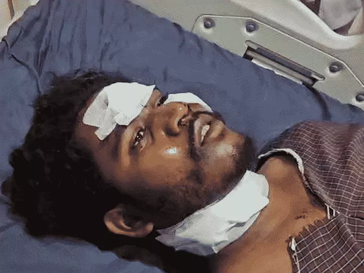 MP : जानलेवा बना चाइनीज मांझा, युवक की गर्दन में आए 14 टांके