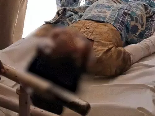 खंडवा में युवती को जिंदा जलाने वाले पिता-पुत्र को उम्रकैद