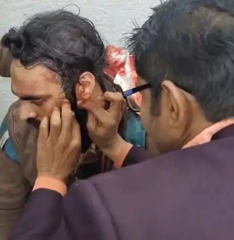 ब्रेकिंग न्यूज़ : इंदौर के इंजीनियर का सिर फोड़ा, पंचमढ़ी में हुई घटना